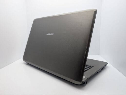 Ноутбук Medion Akoya E7225 / 17.3" (1600x900) TN / Intel Celeron N2840 (2 ядра по 2.16 - 2.58 GHz) / 8 GB DDR3 / 120 GB SSD / Intel HD Graphics / WebCam / DVD-ROM / АКБ не тримає Ноутбук Medion Akoya E7225 / 17.3" (1600x900) TN / Intel Celeron N2840 (2 ядра по 2.16 - 2.58 GHz) / 8 GB DDR3 / 120 GB SSD / Intel HD Graphics / WebCam / DVD-ROM / АКБ не тримає